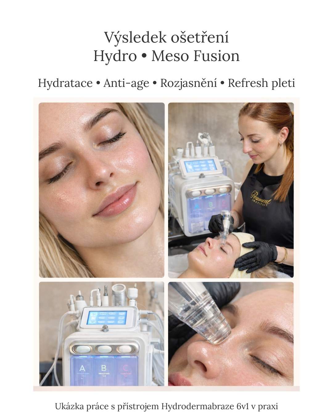 praxe-hydrodermabraze-lifting-pleti